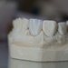 Dentin Dental Studio - laborator tehnica dentara