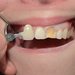 Dentin Dental Studio - laborator tehnica dentara